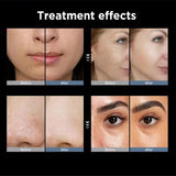 Multi functional facial care device